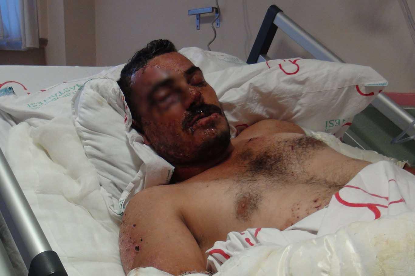 Elazığ’daki patlamada ağır yaralanan kamyoncu o anları anlattı Elazığ’daki patlamada ağır yaralanan kamyoncu o anları anlattı